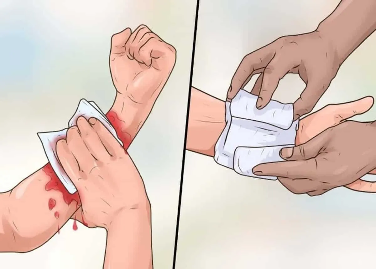 Giải mã giấc mơ bị chó cắn chảy máu